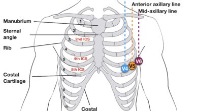 leads ecg
